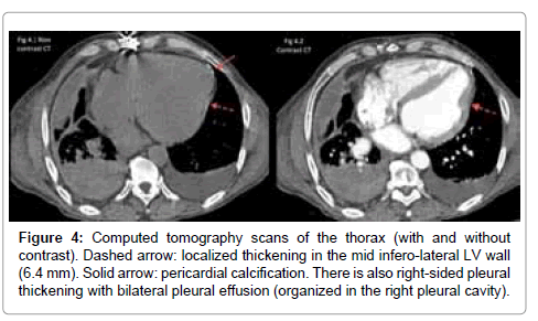 clinical-experimental-cardiology-Computed-tomography