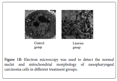 clinical-experimental-cardiology-Electron-microscopy