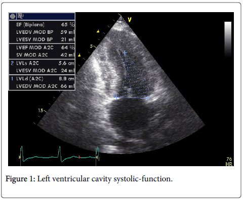 clinical-experimental-cardiology-Left-ventricular