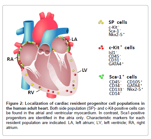 clinical-experimental-cardiology-Localization-cardiac