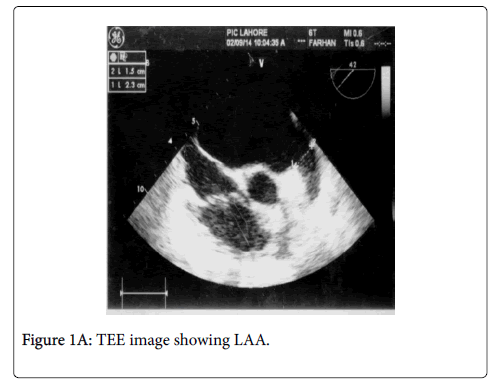 clinical-experimental-cardiology-TEE-image
