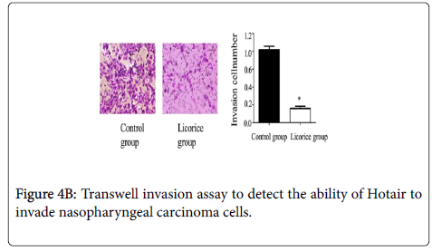 clinical-experimental-cardiology-Transwell-invasion