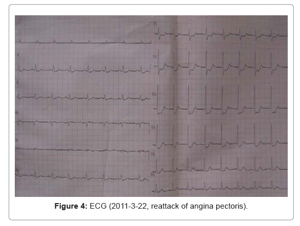 clinical-experimental-cardiology-angina-pectoris