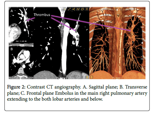 clinical-experimental-cardiology-angiography