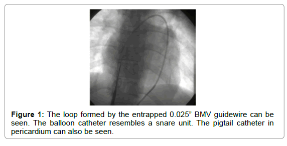 clinical-experimental-cardiology-balloon-catheter