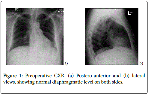 clinical-experimental-cardiology-diaphragmatic