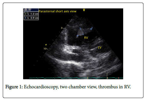 clinical-experimental-cardiology-echocardioscopy