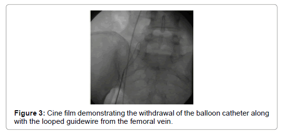 clinical-experimental-cardiology-femoral-vein