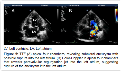 clinical-experimental-cardiology-left-atrium