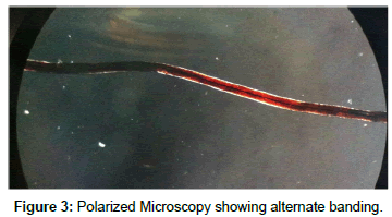 clinical-experimental-dermatology-Polarized-Microscopy