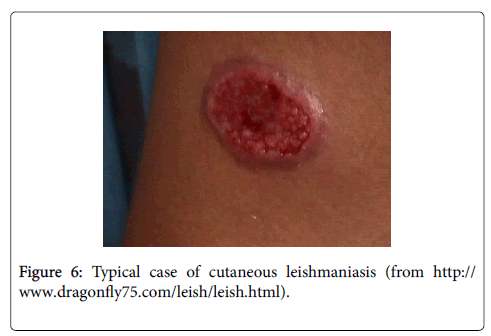 clinical-experimental-dermatology-Typical-case