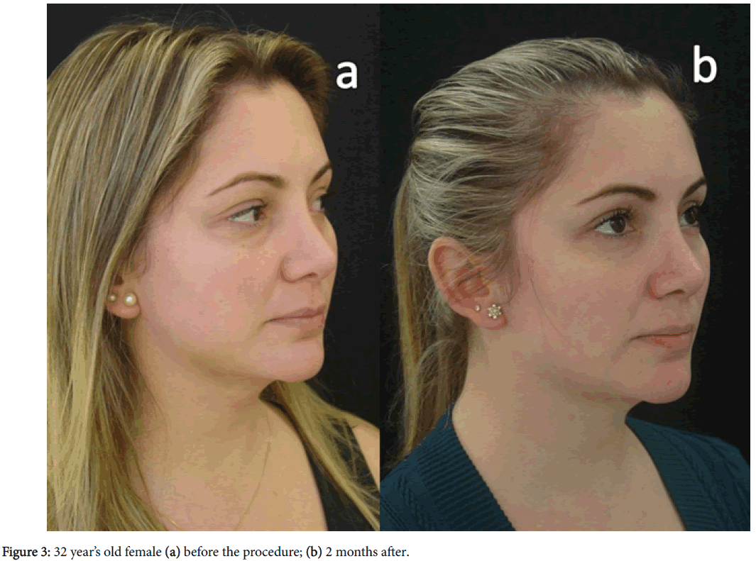 clinical-experimental-dermatology-before-after-procedure