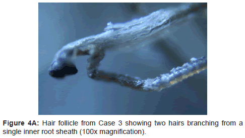 clinical-experimental-dermatology-research-Hair-follicle