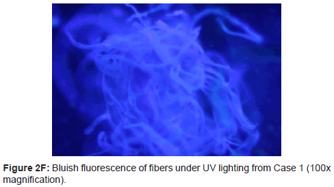clinical-experimental-dermatology-research-fluorescence-fibers