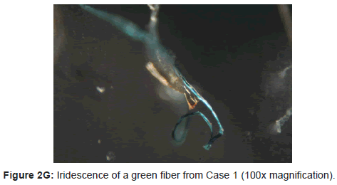 clinical-experimental-dermatology-research-green-fiber