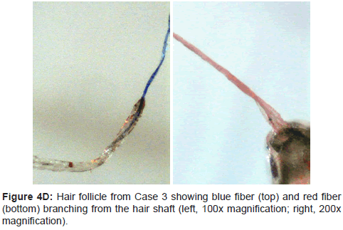 clinical-experimental-dermatology-research-hair-shaft