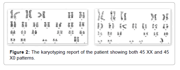 clinical-experimental-dermatology-research-karyotyping-report