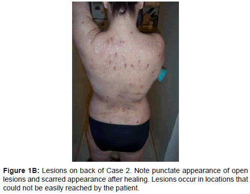 clinical-experimental-dermatology-research-punctate-appearance