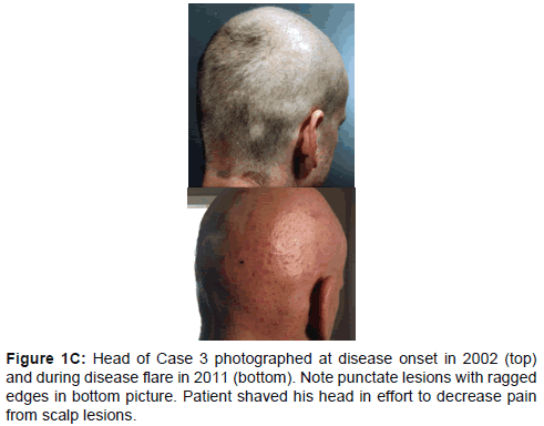clinical-experimental-dermatology-research-scalp-lesions