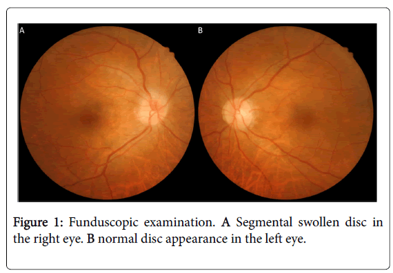 clinical-experimental-ophthalmology-Funduscopic-examination