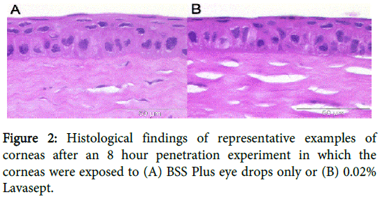 clinical-experimental-ophthalmology-Histological-findings