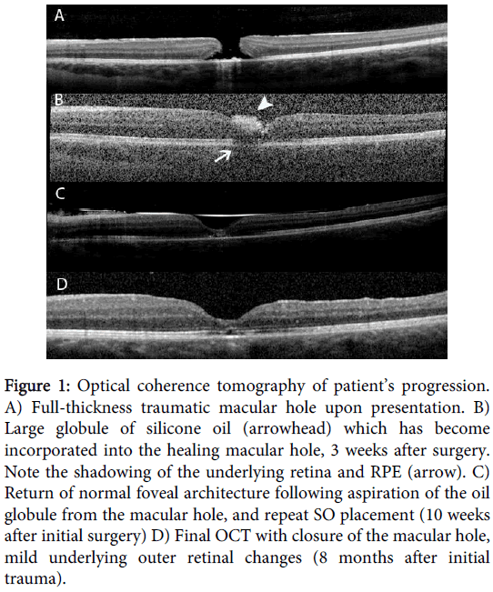 clinical-experimental-ophthalmology-Optical-coherence