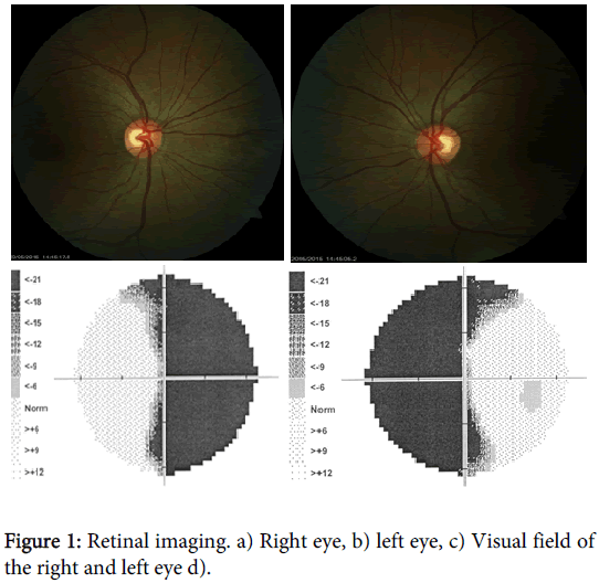 clinical-experimental-ophthalmology-Retinal-imaging