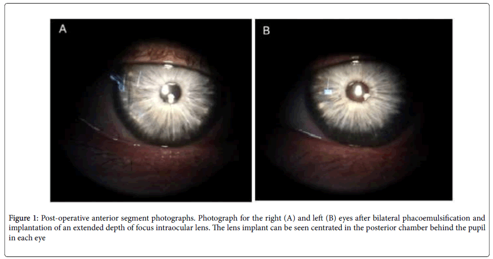 clinical-experimental-ophthalmology-anterior-segment