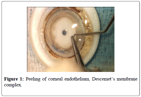 clinical-experimental-ophthalmology-corneal-endothelium