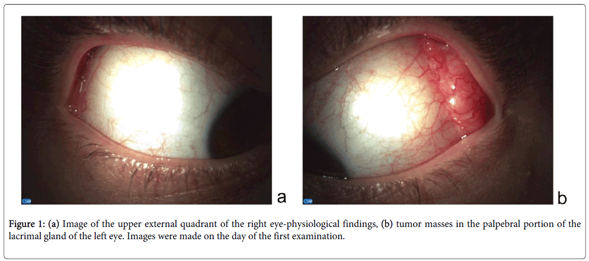 clinical-experimental-ophthalmology-external-quadrant