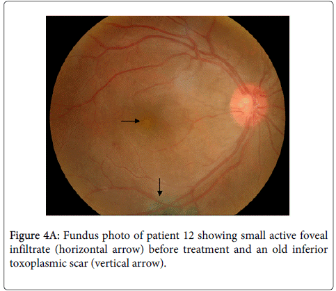clinical-experimental-ophthalmology-horizontal-arrow