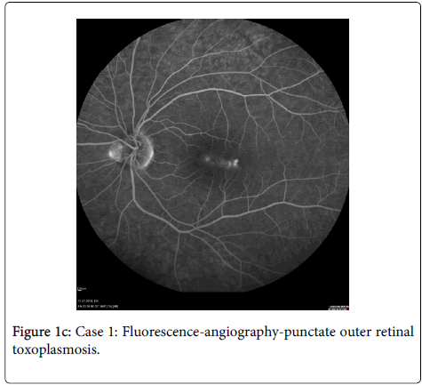 clinical-experimental-ophthalmology-outer-retinal