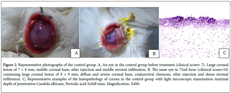 clinical-experimental-ophthalmology-silier-injection