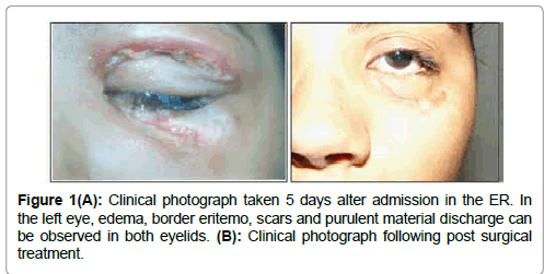 clinical-ophthalmology-Clinical-photograph