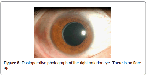 clinical-ophthalmology-anterior-eye