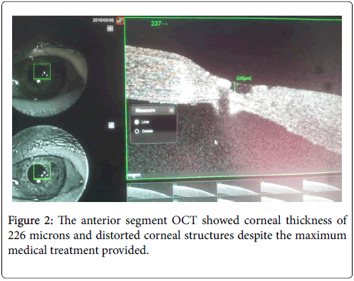 clinical-ophthalmology-anterior-segment