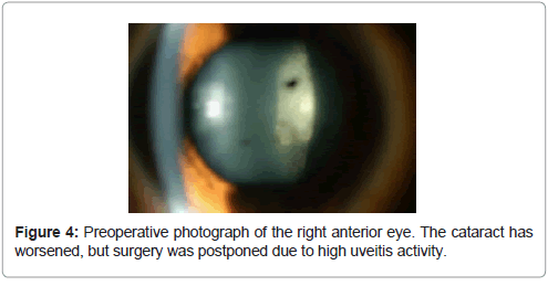 clinical-ophthalmology-ocular-fundus