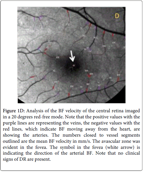 clinical-ophthalmology-red-lines