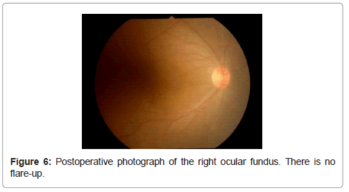 clinical-ophthalmology-right-ocular