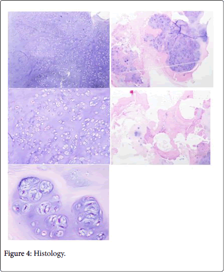 clinical-research-foot-ankle-Histology