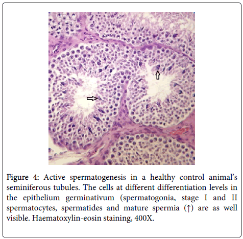 clinical-toxicology-Active-spermatogenesis