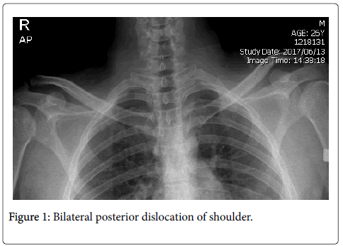 clinical-toxicology-Bilateral-posterior