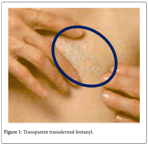 Image of durogesic transdermal patch 25 mcg-hr