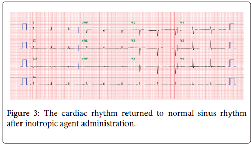 clinical-toxicology-cardiac-rhythm