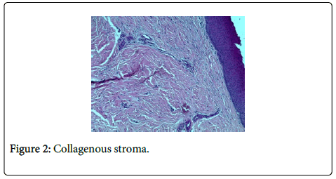 clinical-trials-Collagenous-stroma