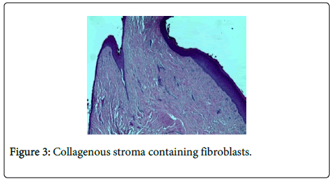 clinical-trials-Collagenous-stroma-fibroblasts