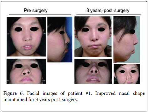clinical-trials-Facial-images