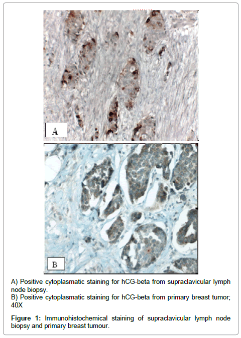 clinical-trials-Immunohistochemical-staining