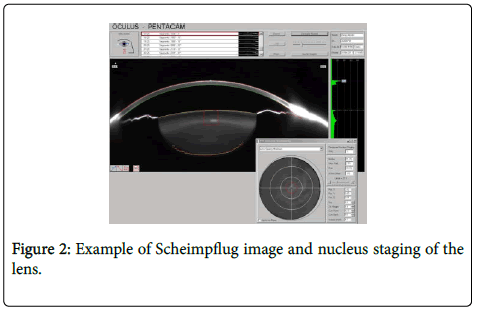 clinical-trials-Scheimpflug-image