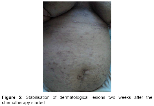 clinical-trials-Stabilisation-dermatological-lesions